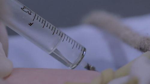 一针视频,揭秘XX领域的惊人发现